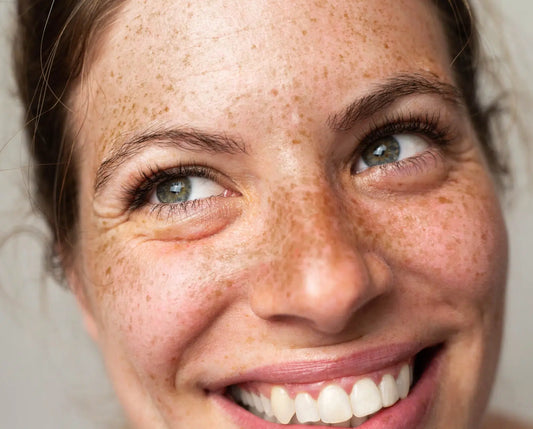 Taches pigmentaires sur le visage : causes et solutions