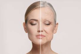 anti age 
