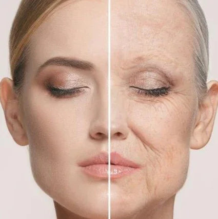 ANTI-AGE