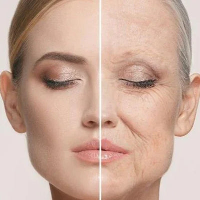 ANTI-AGE